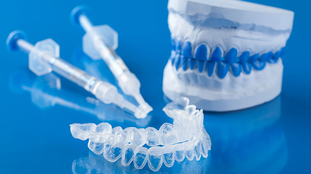 ホームホワイトニングの特長