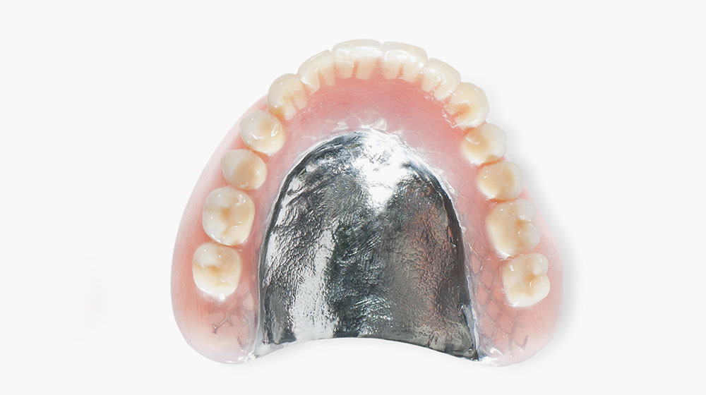 金属床義歯