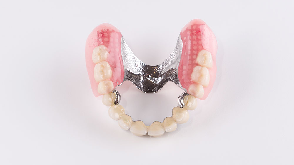 アタッチメント義歯・マグネット義歯