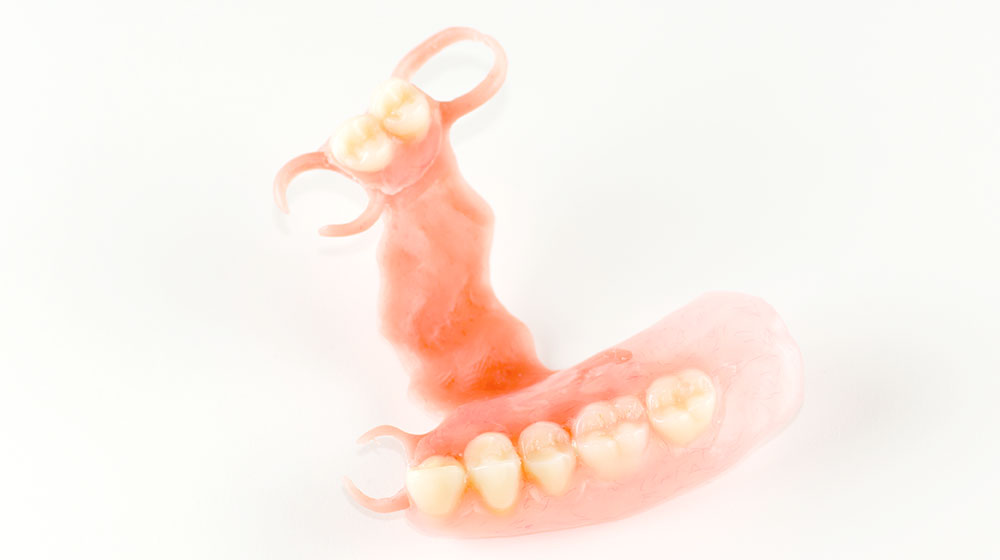 ノンクラスプ義歯