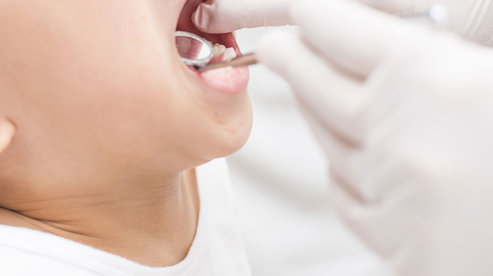 永久歯を抜く可能性が減る