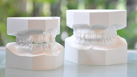 STEP3 診断・治療計画の決定