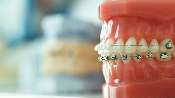 STEP7 本格治療(12歳~)