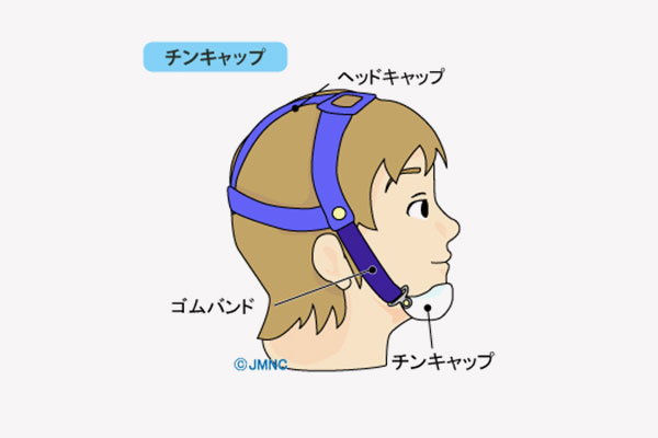 歯列矯正用チンキャップ