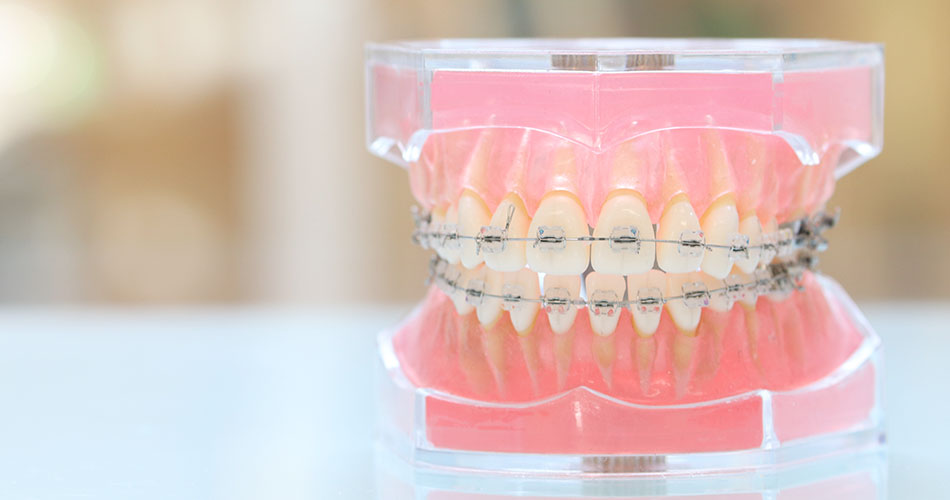 01.目立つ装置を装着することに抵抗がある方