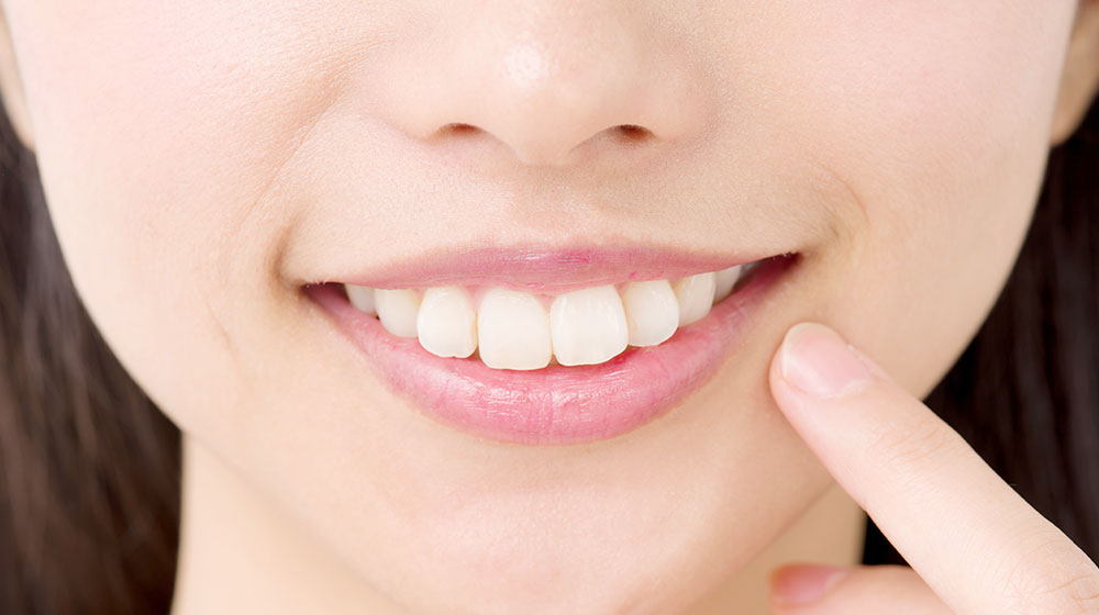 前歯を後方に引っ込めやすい