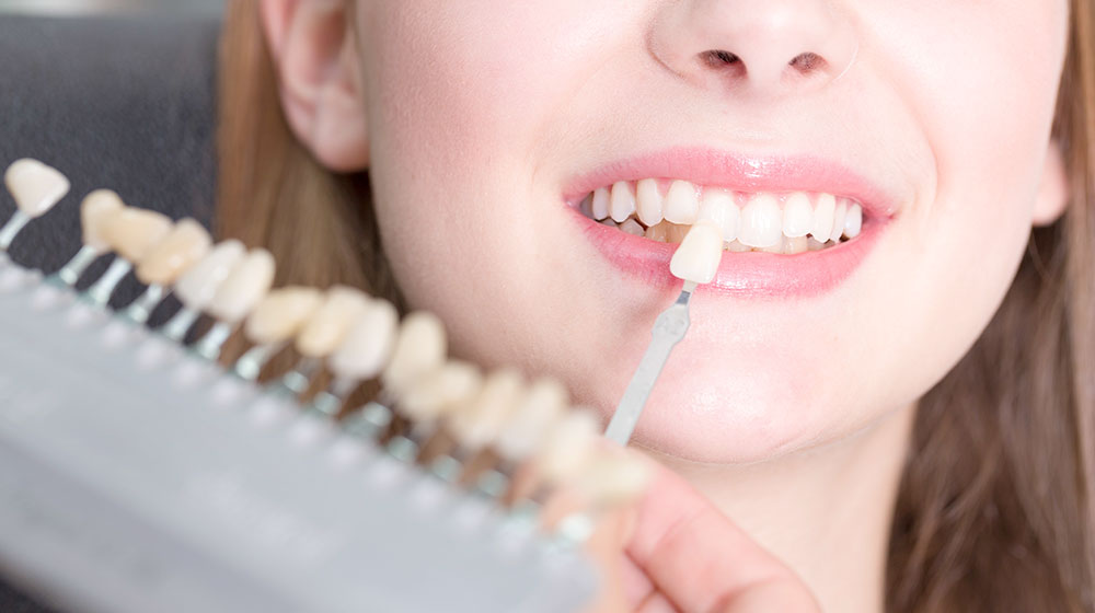 ホワイトニングが同時にできる